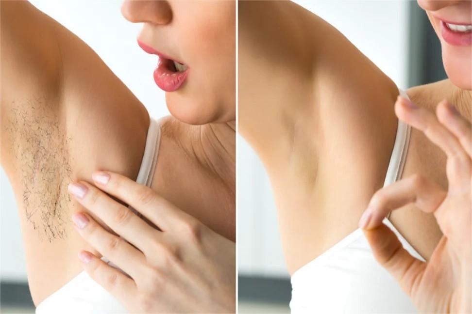 Best IPL Hair Removal Devices 2023: Say Goodbye to Unwanted Hair Forever!