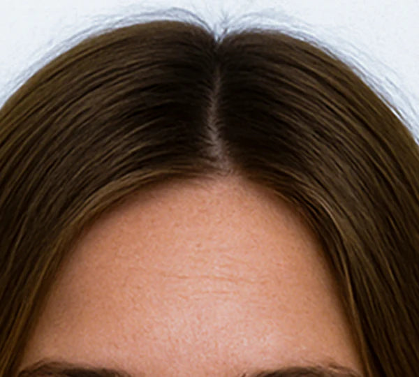 After image